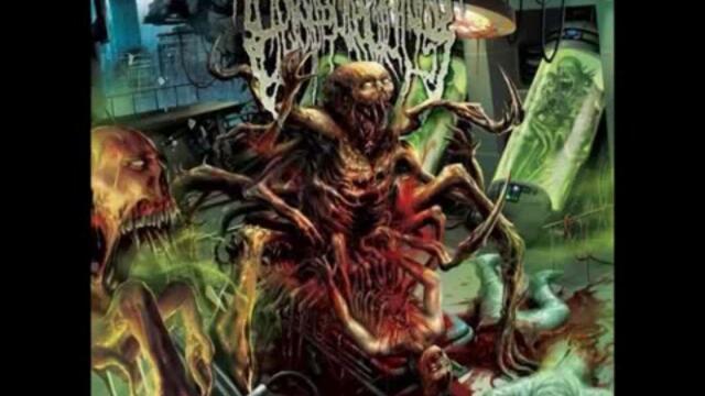 Epicardiectomy - Putreseminal Morphodysplastic Virulency - Full Album - Part 1