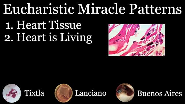 Inspired By Carlo Acutis - Scientific Evidence of Eucharistic Miracles