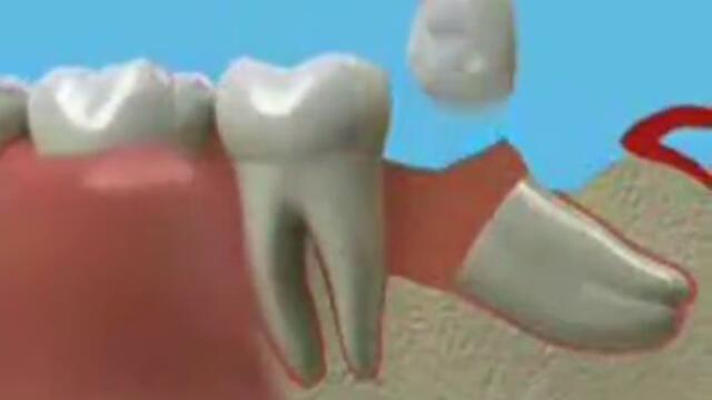 Зъбите ни и как да ги лекуваме - Зъболечение - Уроци - 2013 г.