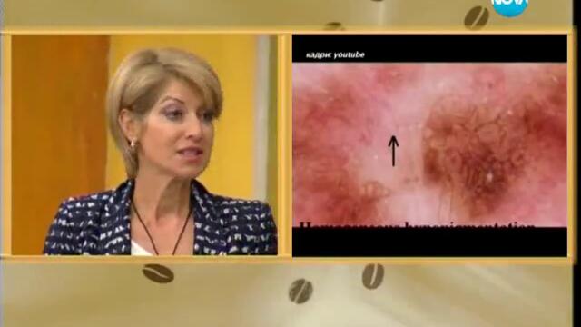 На кафе с Гала-темата за пигментните петна,гост д-р Катя Паскова 1